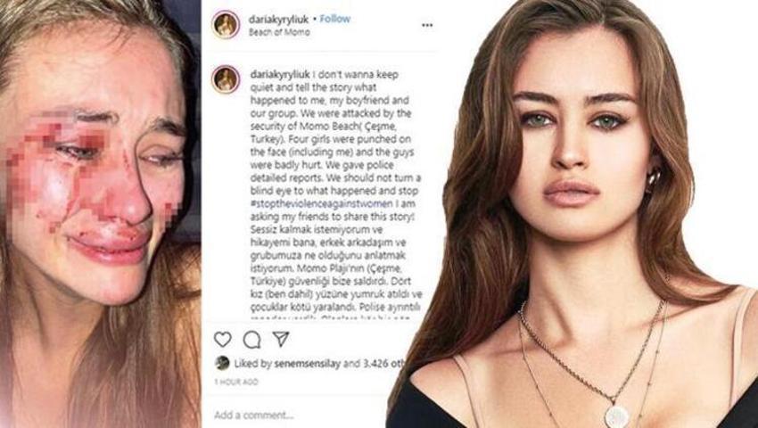 Daria Kyryliuk’un darp olayında sürpriz gelişme! Sevgilisi mi dövdü?