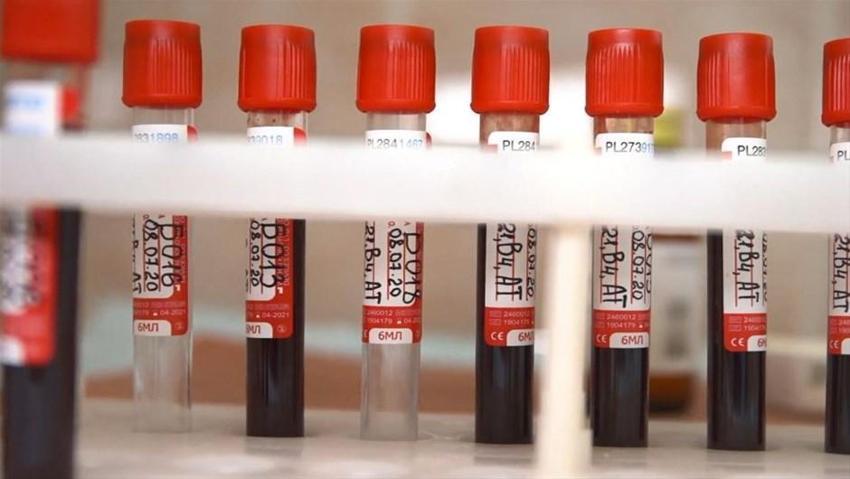 Rusya'dan aşı müjdesi gelmişti! İlginç anket sonucu, yüzde 52...