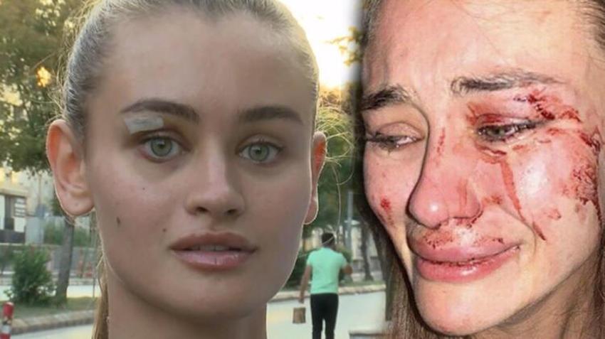 Yalan ortaya çıktı! Ukraynalı model Daria Kyryliuk o partide virüs kaptı