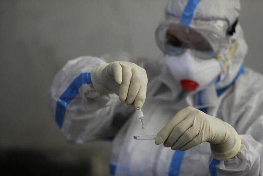 Afrika'da corona virüs salgınıyla mücadelede şaşırtan durum!