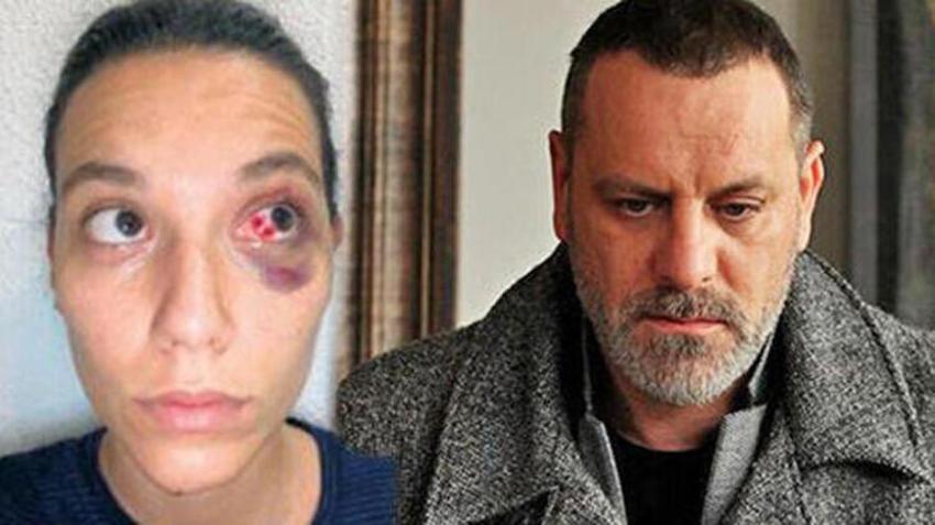 Deniz Bulutsuz aylar sonra ortaya çıktı!