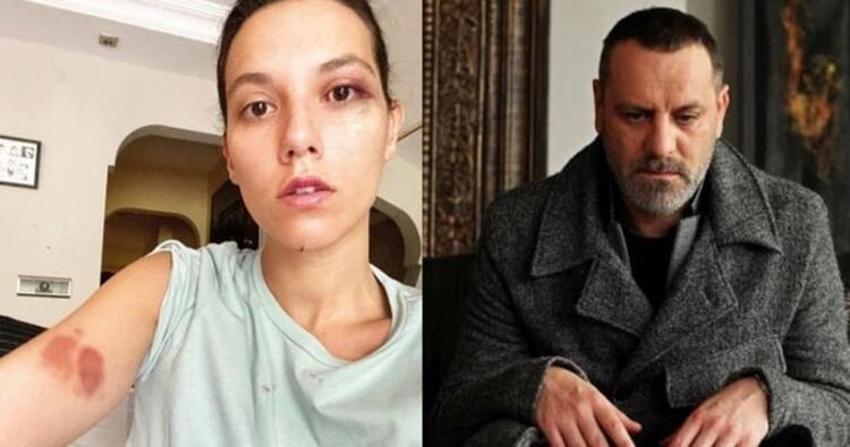 Deniz Bulutsuz: Kendimi çok kötü hissediyorum