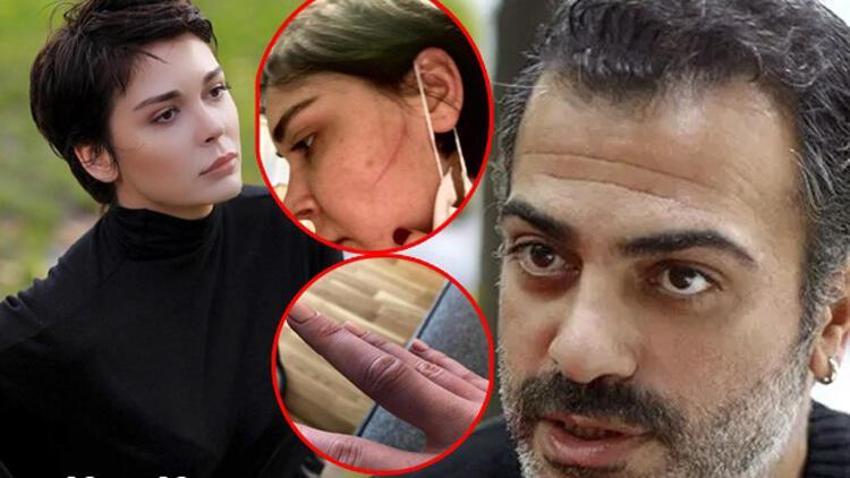 Sevcan Yaşar: Sermiyan Midyat dövüp çıplak videomu çekti