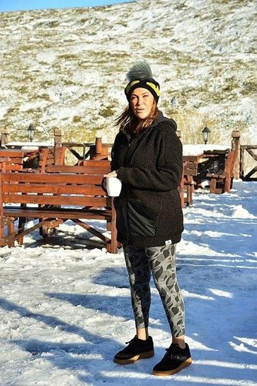 Hülya Avşar'ın yüzüne ne oldu? Morlukların sebebi...