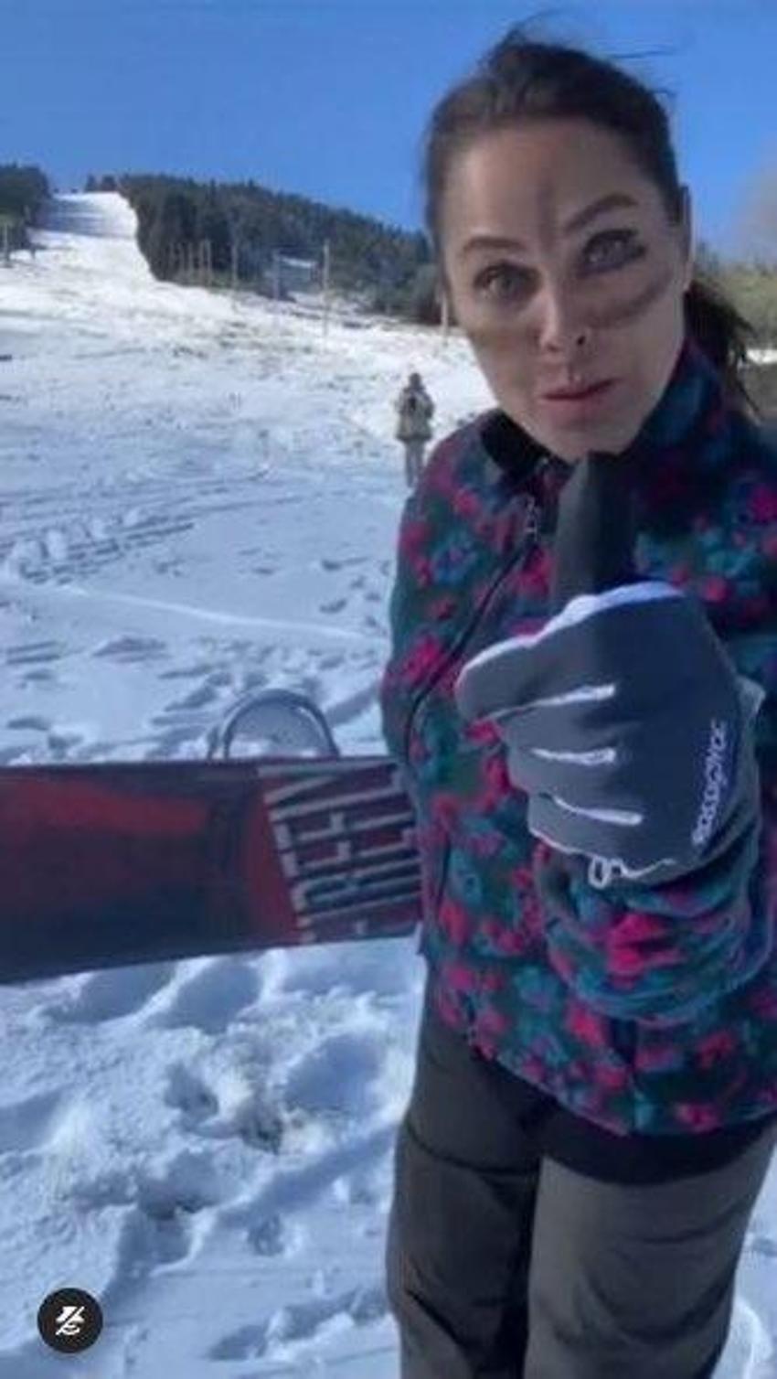 Hülya Avşar'ın yüzüne ne oldu? Morlukların sebebi...