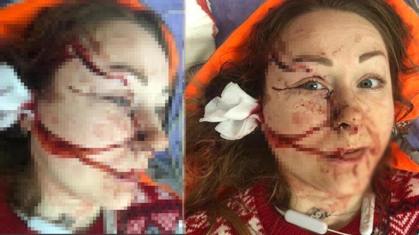 Boşanmak isteyen eşini falçata ile doğradı