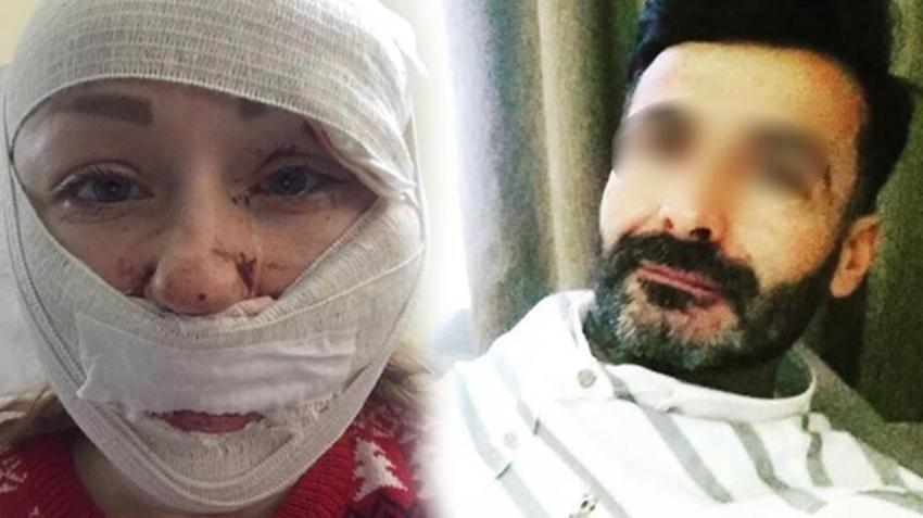 Boşanmak isteyen eşini falçata ile doğradı