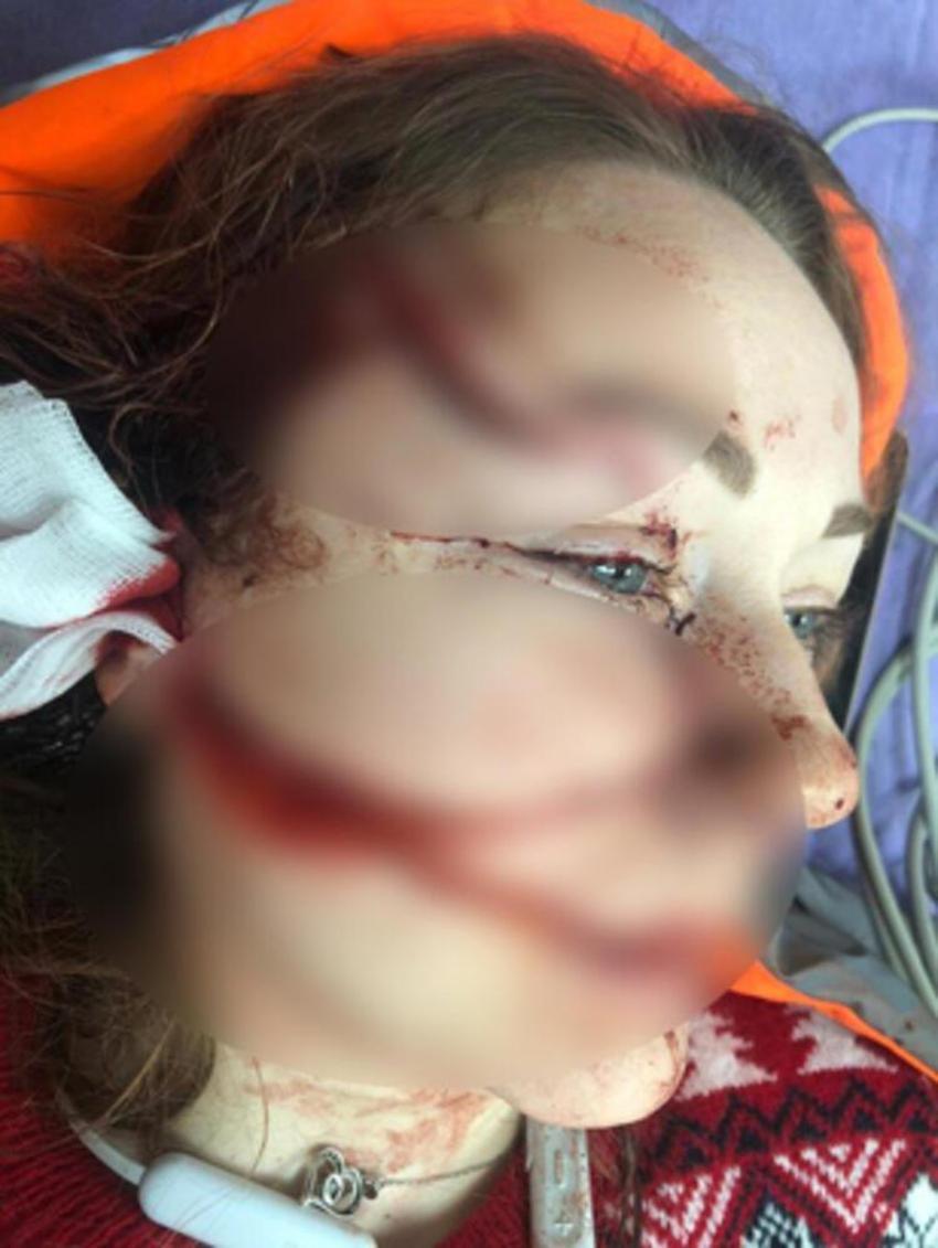 Boşanmak isteyen eşini falçata ile doğradı