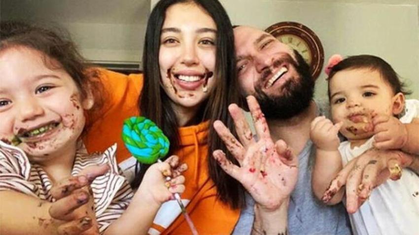 Berkay saç ektirdi: Nasıl olmuş?