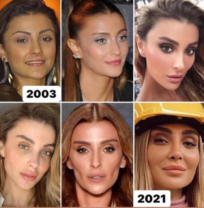 Özge Ulusoy'dan 'çöp poşeti' açıklaması! 'Çok güldürdü'
