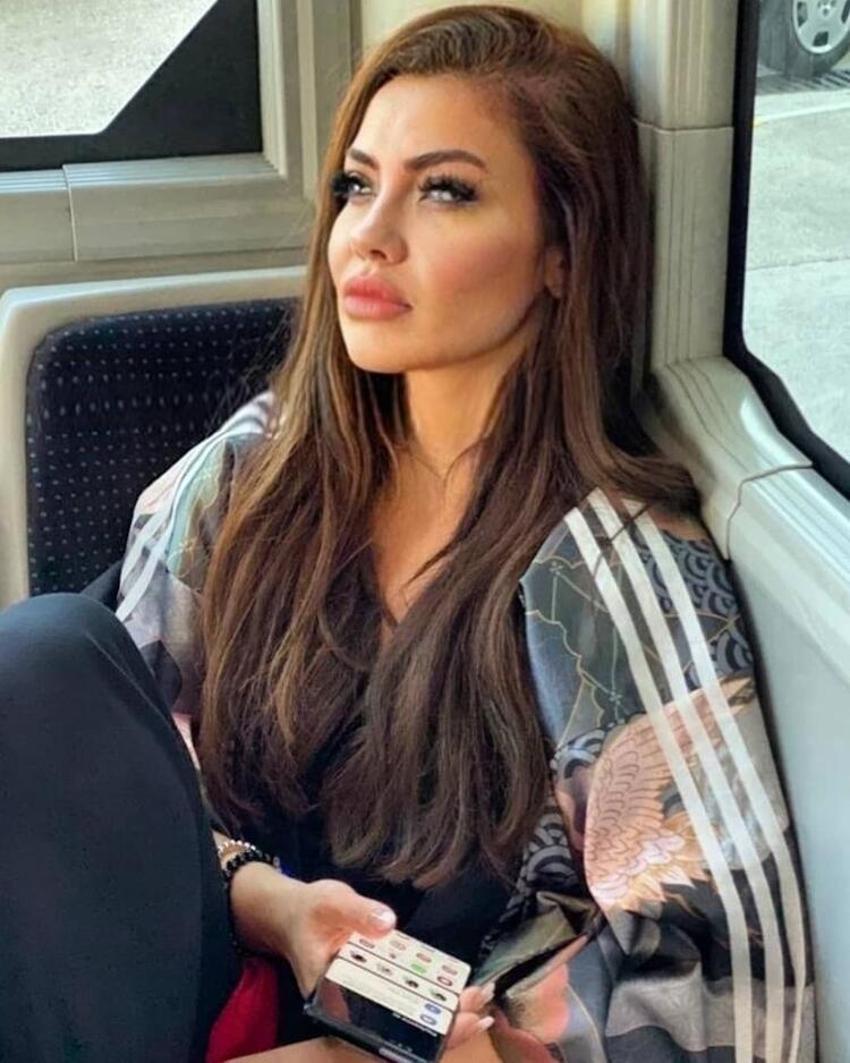 Lara pişmanlığını gözyaşları içinde anlattı! 'Dudağımla pipet bile tutamıyorum'