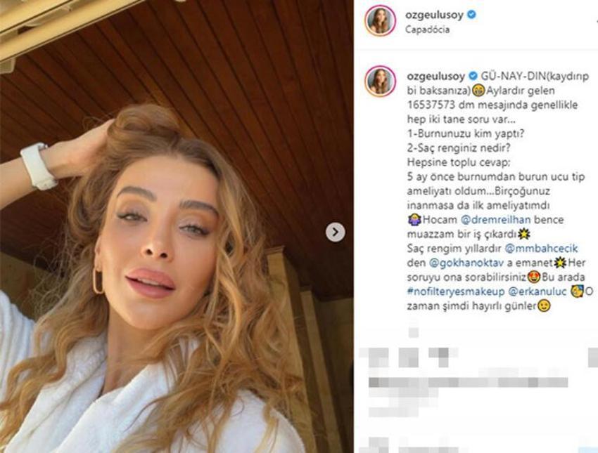 Özge Ulusoy'dan estetik itirafı! 'Muazzam bir iş çıkardı'