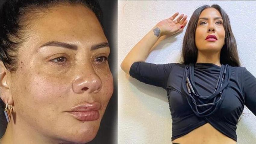 Işın Karaca sevgilisi Can Yapıcıoğlu'nu öpücük yağmuruna tuttu!