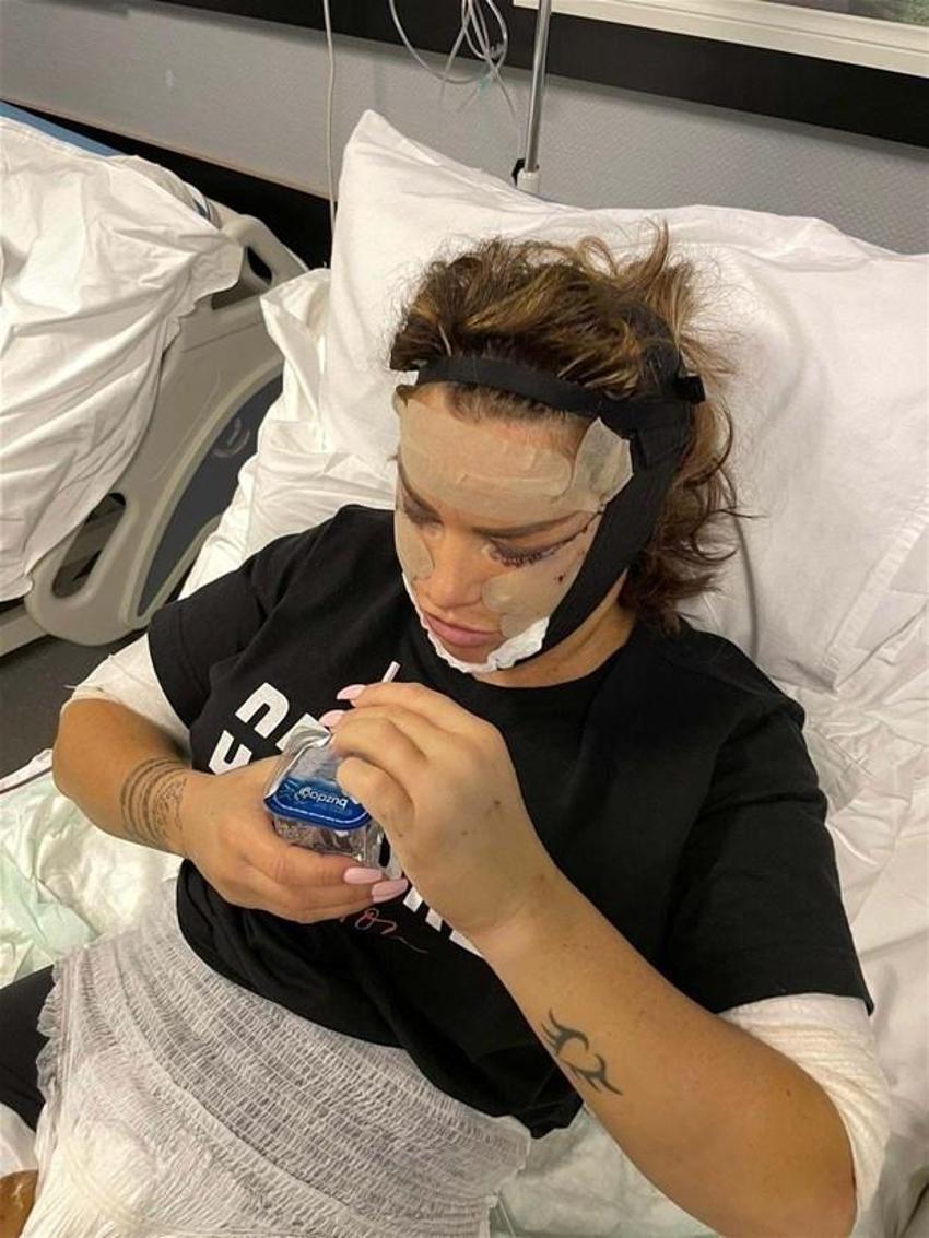 Katie Price yine bıçak altına yattı! Eski kocası çıldırdı...