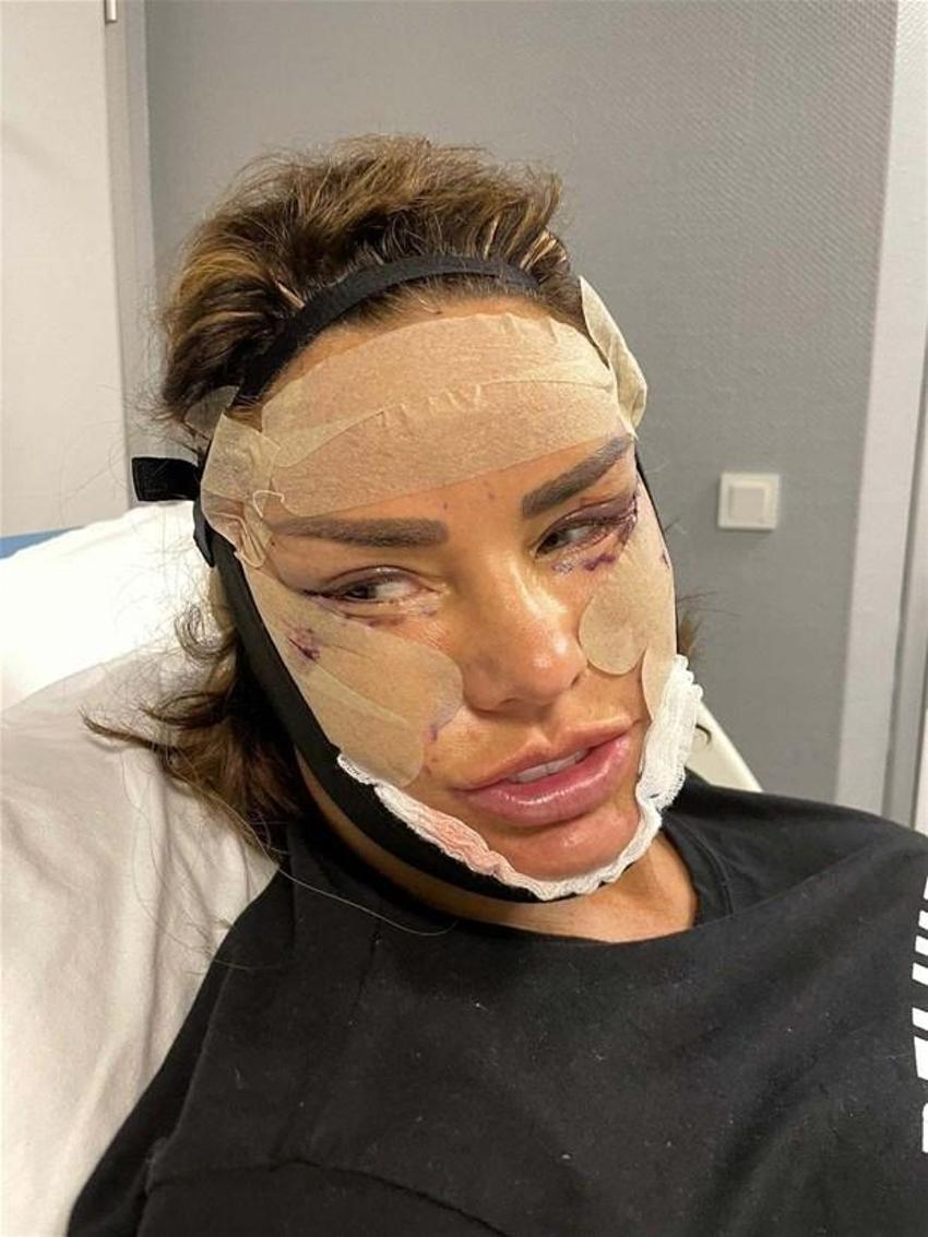 Katie Price yine bıçak altına yattı! Eski kocası çıldırdı...
