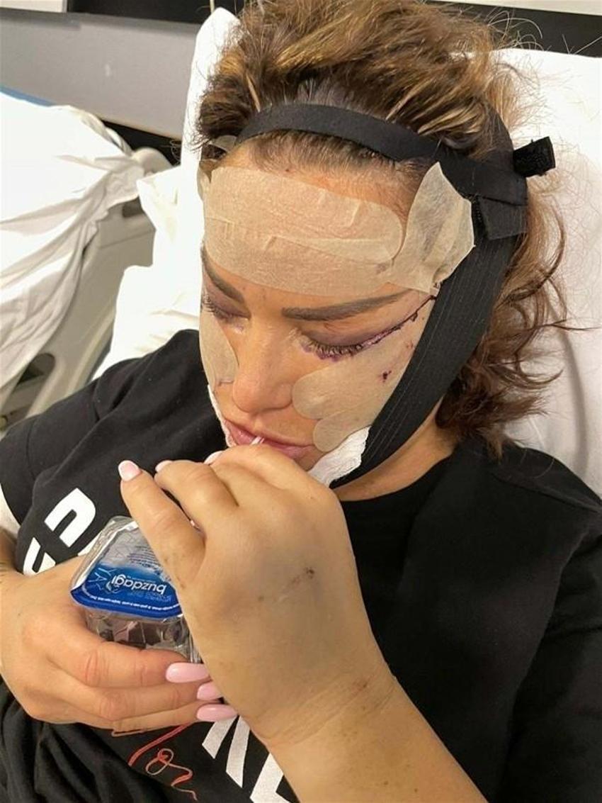 Katie Price yine bıçak altına yattı! Eski kocası çıldırdı...