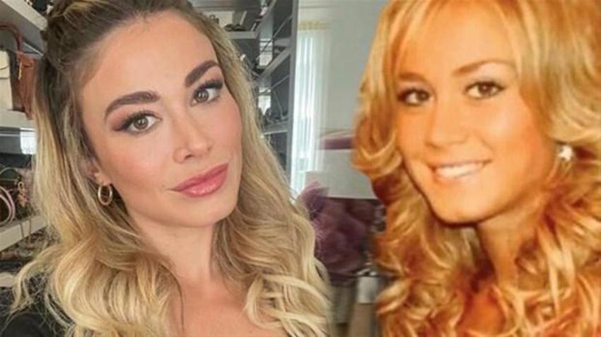 Can Yaman'ın sevgilisi Diletta Leotta'nın estetiksiz halini gören şaşırdı!