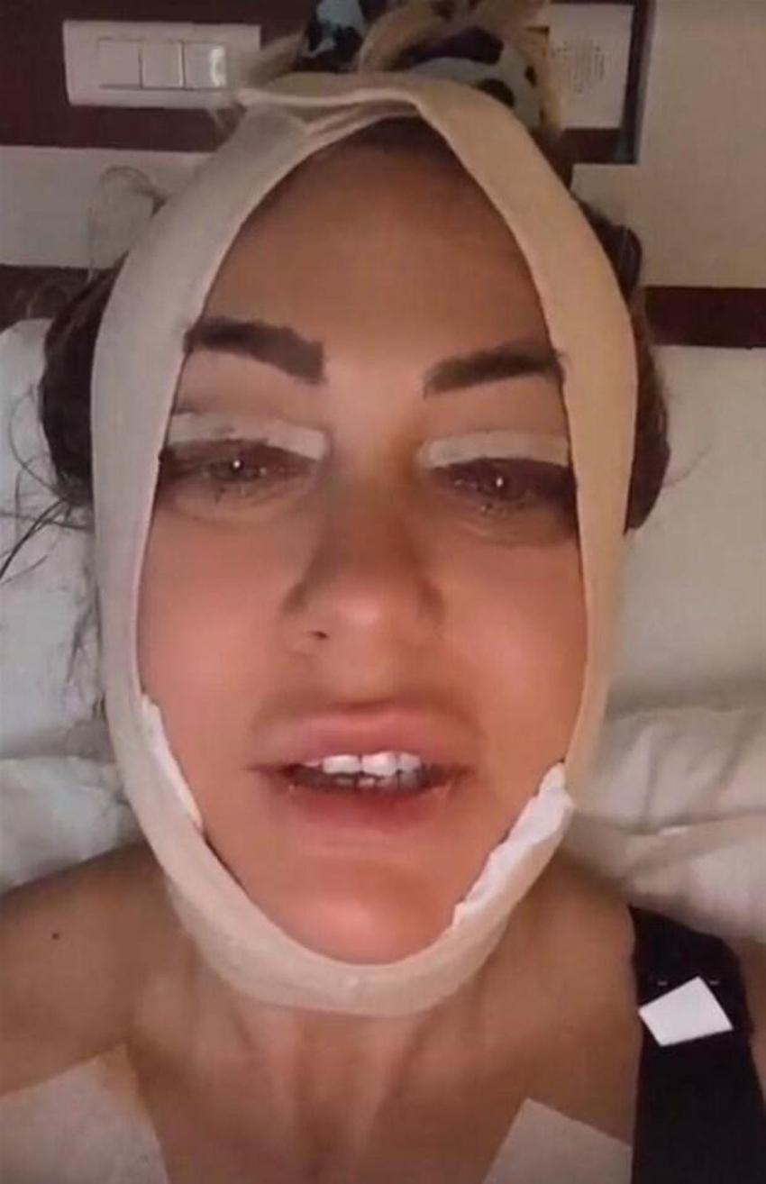 Serap Paköz '“Benim neyim eksik' dedi! İşte estetikli ünlü isimler!