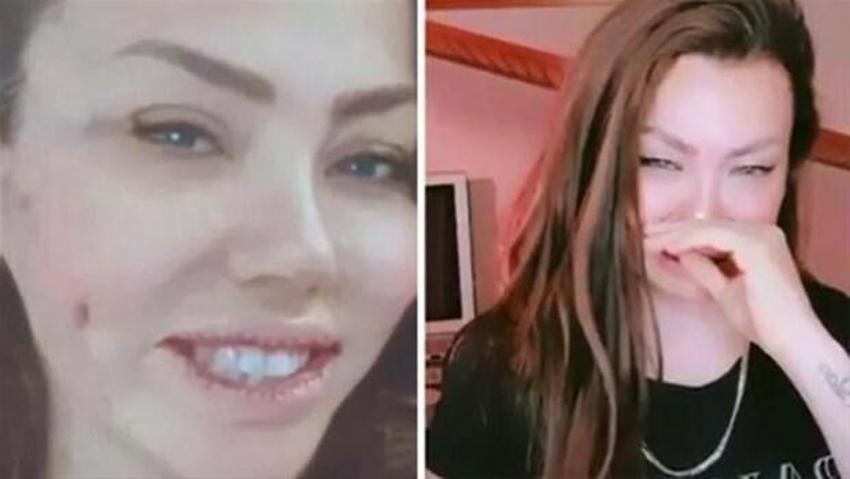 Serap Paköz '“Benim neyim eksik' dedi! İşte estetikli ünlü isimler!