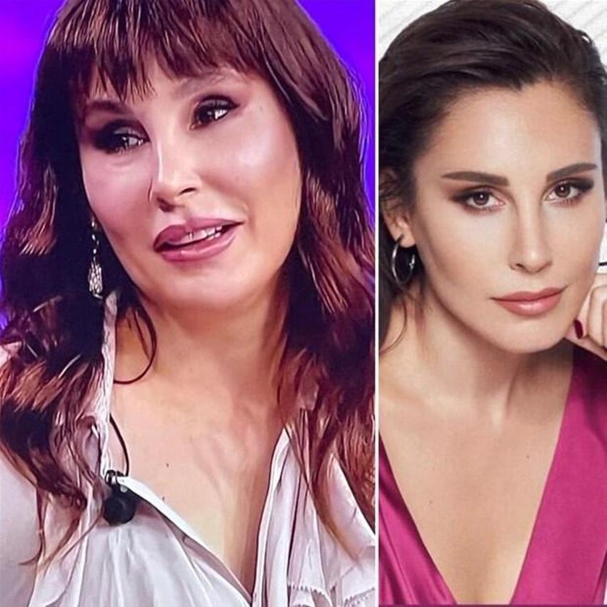 Serap Paköz '“Benim neyim eksik' dedi! İşte estetikli ünlü isimler!