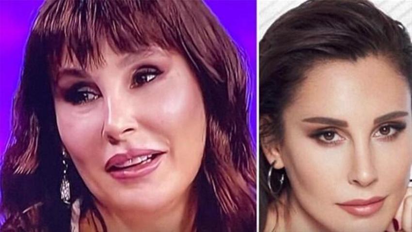 Serap Paköz '“Benim neyim eksik' dedi! İşte estetikli ünlü isimler!