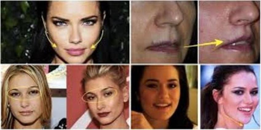 Serap Paköz '“Benim neyim eksik' dedi! İşte estetikli ünlü isimler!