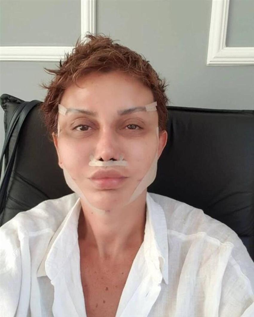 Serap Paköz '“Benim neyim eksik' dedi! İşte estetikli ünlü isimler!