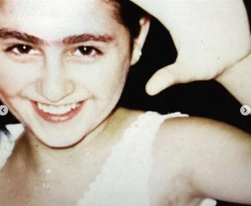 Estetikle Michael Jackson'a benzetilen Günel Zeynalova estetiksiz halini paylaştı
