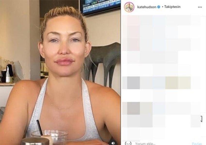 Ünlü oyuncu Kate Hudson şoke etti! 'Bana ne yaptınız böyle'