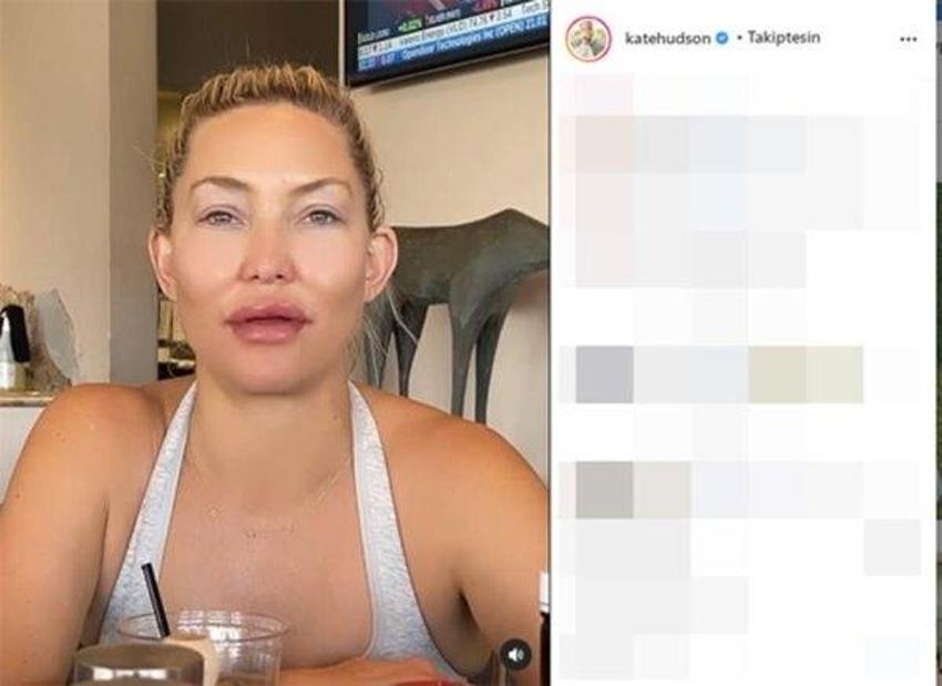 Ünlü oyuncu Kate Hudson şoke etti! 'Bana ne yaptınız böyle'