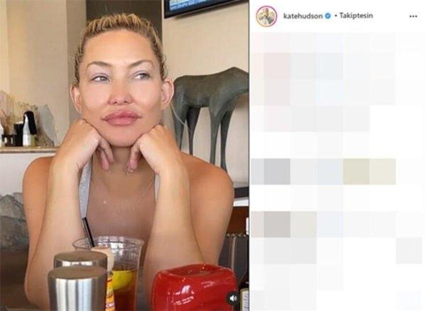 Ünlü oyuncu Kate Hudson şoke etti! 'Bana ne yaptınız böyle'