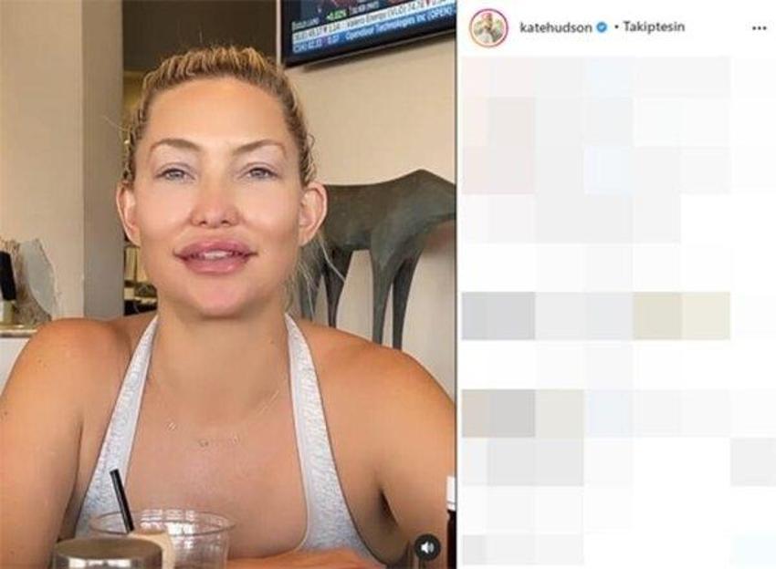 Ünlü oyuncu Kate Hudson şoke etti! 'Bana ne yaptınız böyle'
