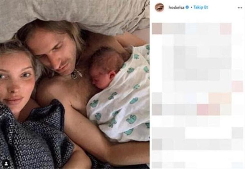 Emzirme pozları çok konuşulan Elsa Hosk'tan yanıt geldi!