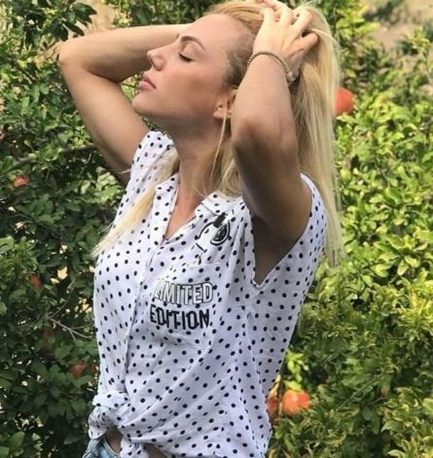 Survivor'ın yıldızı Funda Alkayış'ın estetikli hali gündem oldu!