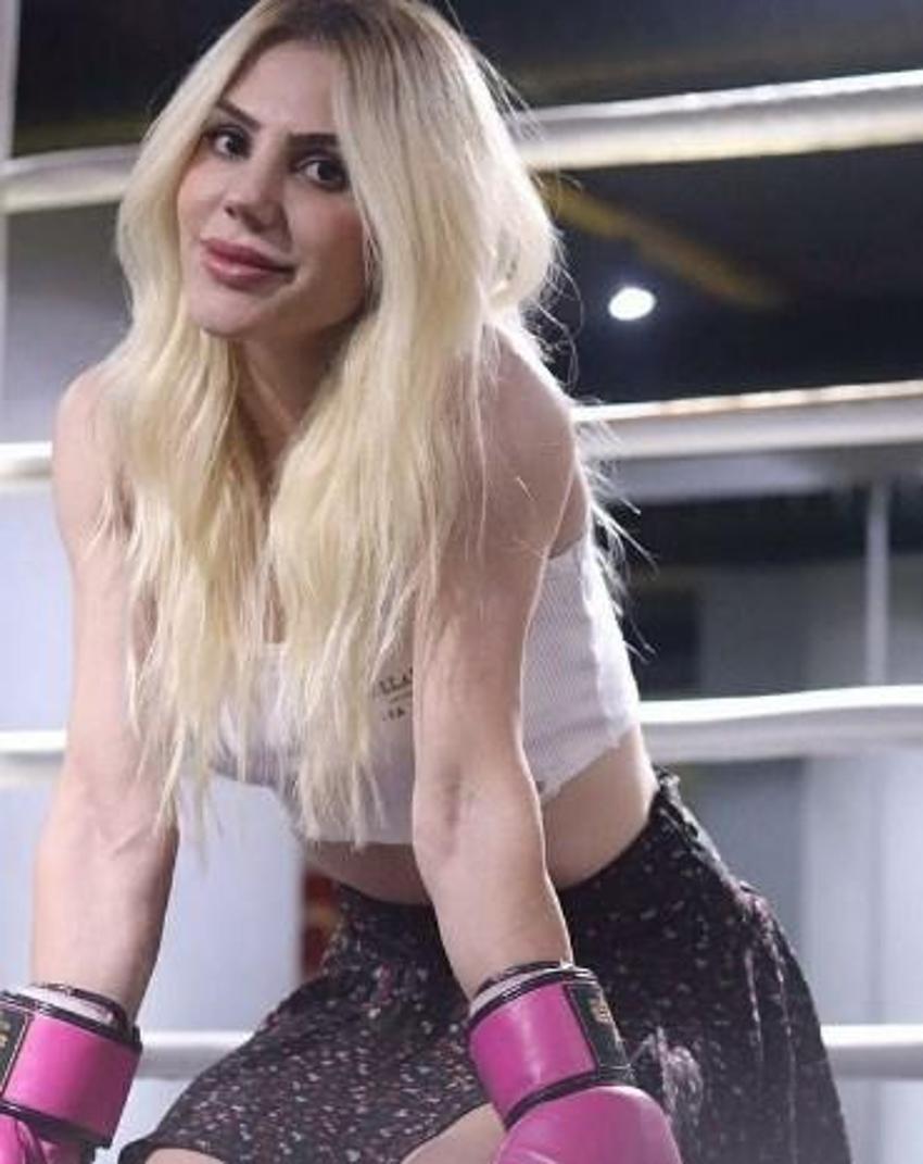 Survivor'ın yıldızı Funda Alkayış'ın estetikli hali gündem oldu!