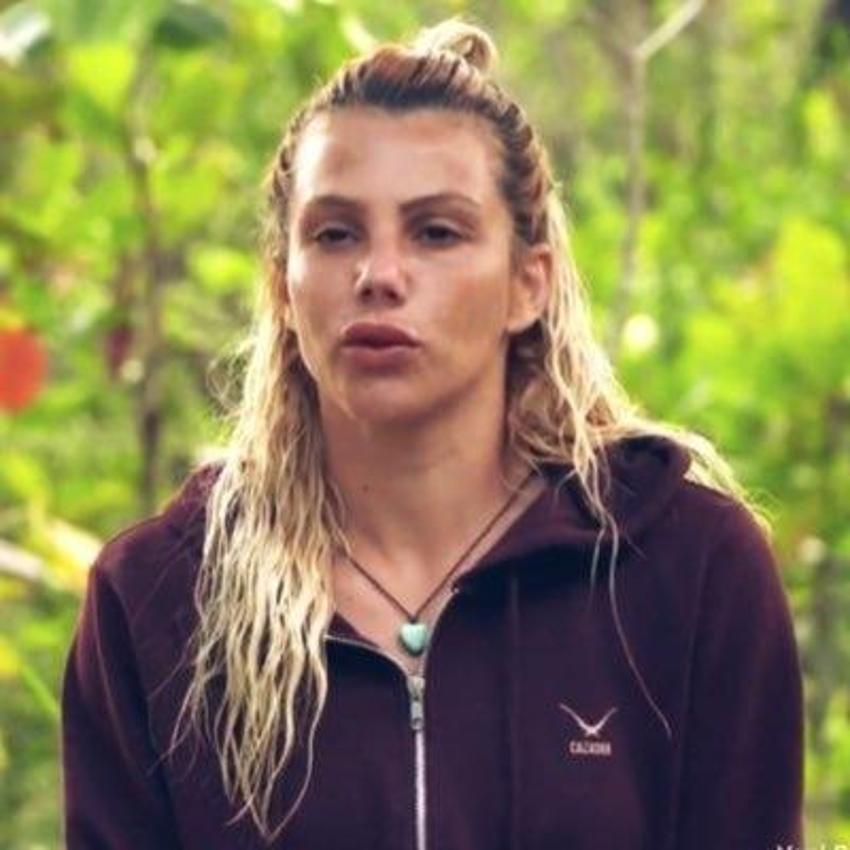 Survivor'ın yıldızı Funda Alkayış'ın estetikli hali gündem oldu!