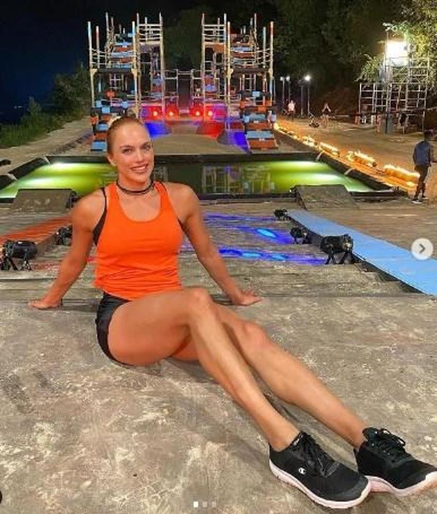 Eski Survivor yarışmacısı Birsen Bekgöz estetikli hali inanılmaz!