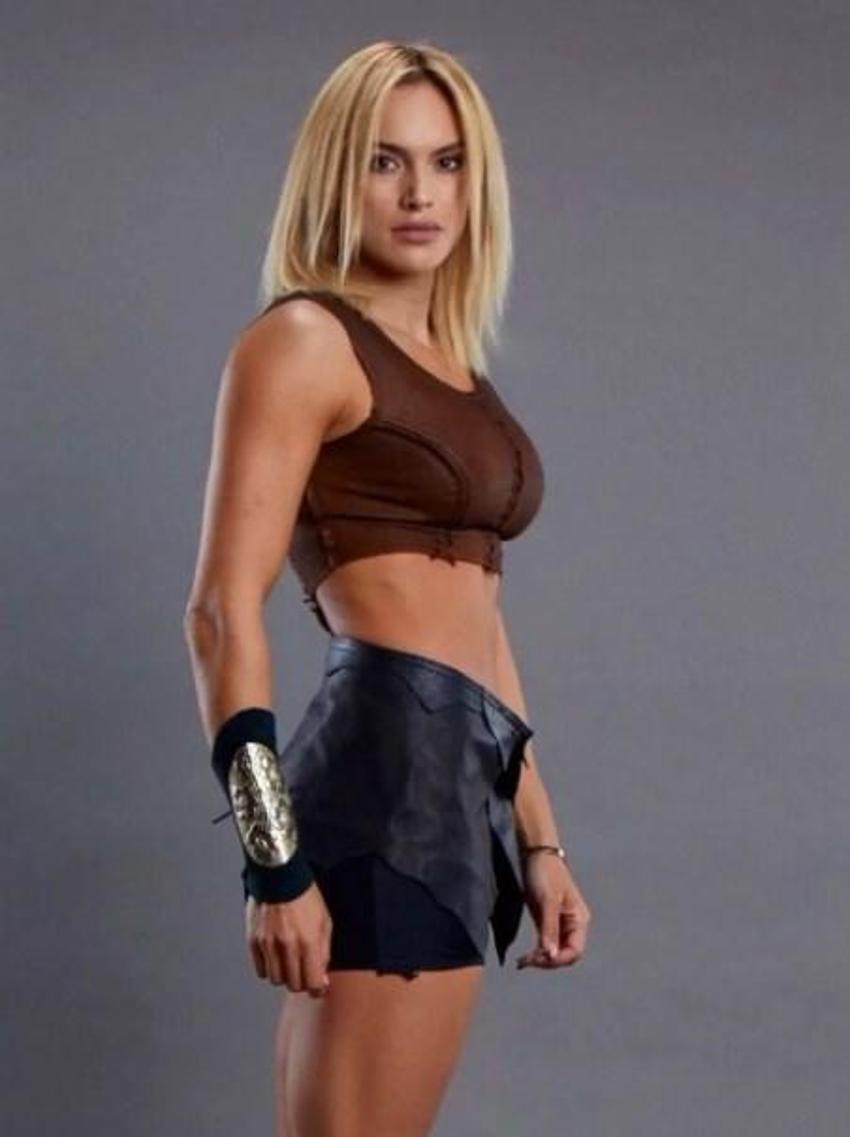 Eski Survivor yarışmacısı Birsen Bekgöz estetikli hali inanılmaz!