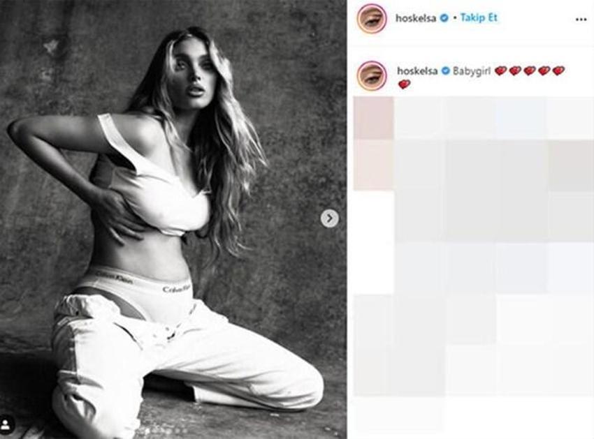 Elsa Hosk'un doğum itirafı şaşırttı!