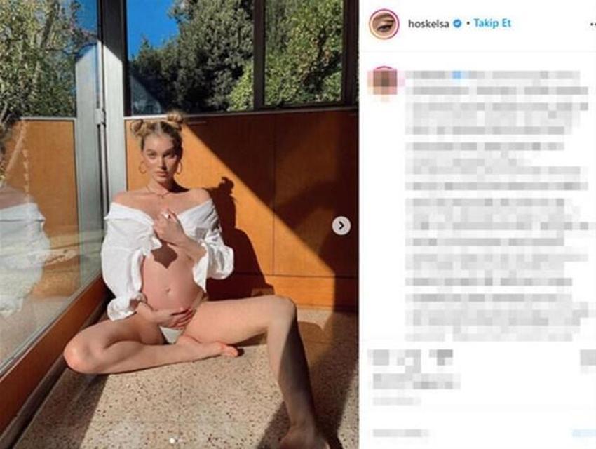 Elsa Hosk'un doğum itirafı şaşırttı!