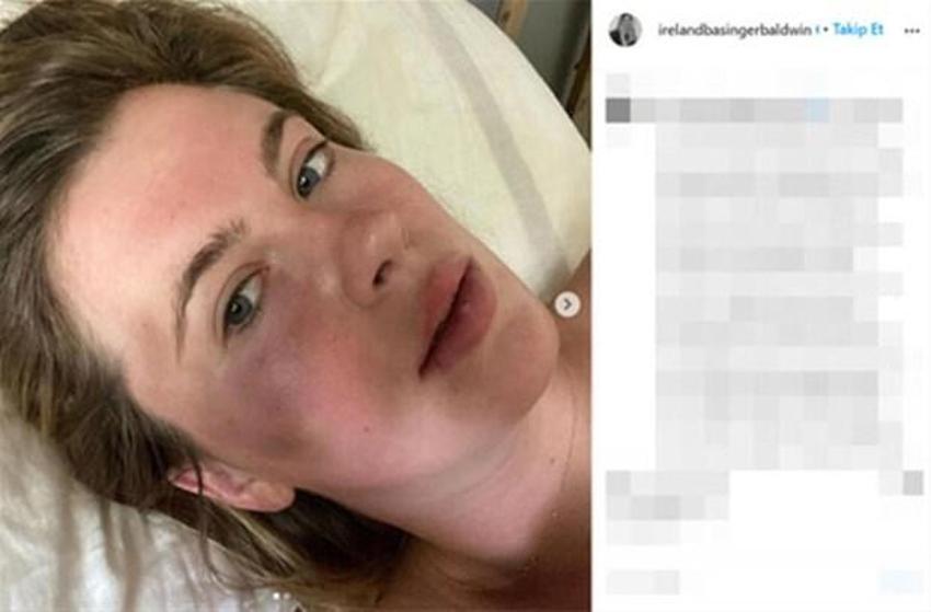 Ireland Baldwin'in zor anları!