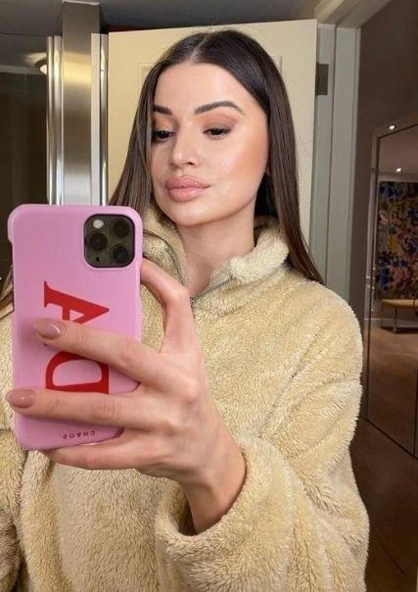 Ablasının kopyası! Hadise’nin kız kardeşi Derya Açıkgöz'ün eski halinden eser yok!