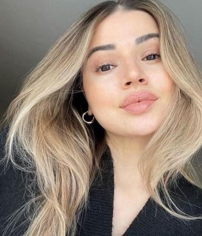 Ablasının kopyası! Hadise’nin kız kardeşi Derya Açıkgöz'ün eski halinden eser yok!