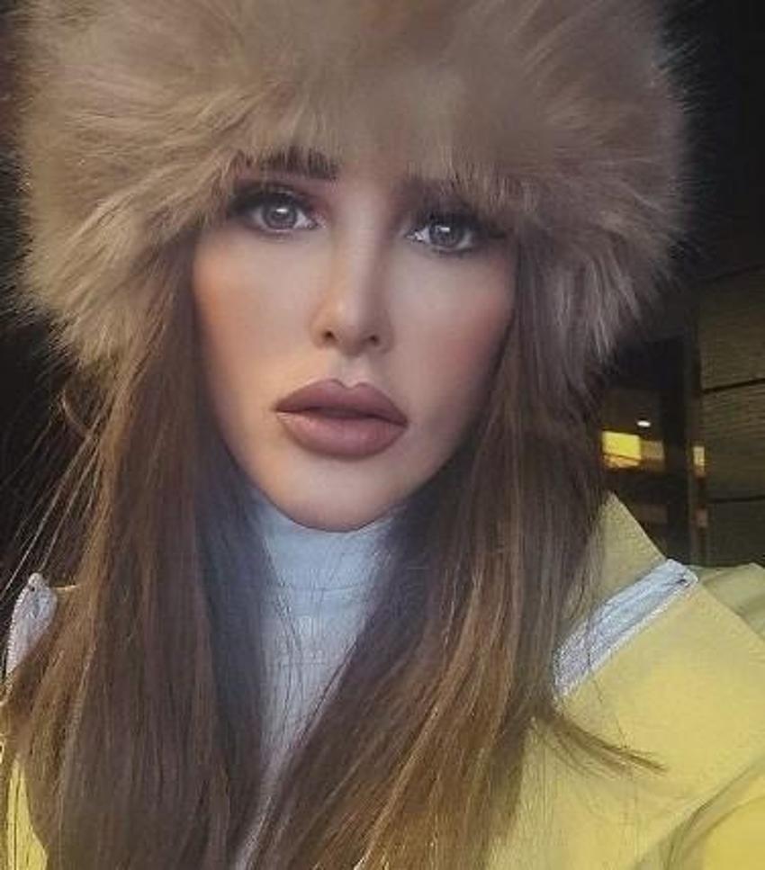 'Ameliyat olmazsam yaza çıkmazmışım' diyen Seren Serengil kayağa gitti!