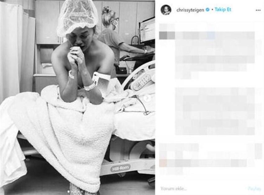 Chrissy Teigen kötü günleri geride bıraktı!