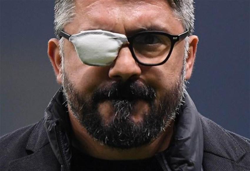 Napoli teknik direktörü Gennaro Gattuso: Öldüğümü okudum, 1 aylık ömrüm kalmış...