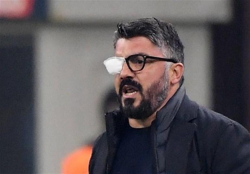 Napoli teknik direktörü Gennaro Gattuso: Öldüğümü okudum, 1 aylık ömrüm kalmış...