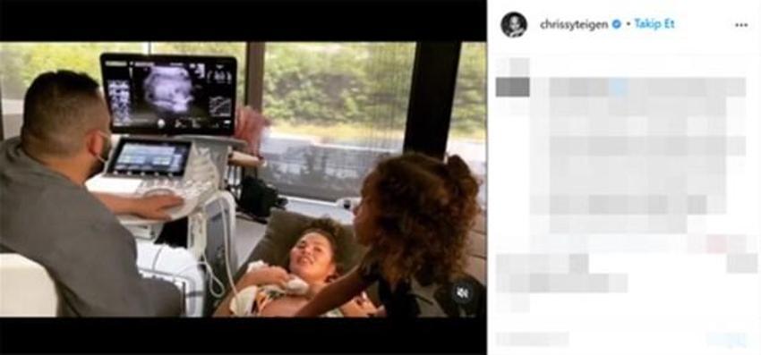 Chrissy Teigen'den kötü haber! 'Daha önce böyle bir acı hissetmemiştik'