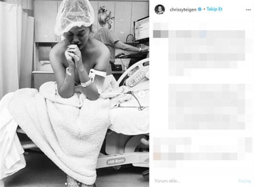 Chrissy Teigen'den kötü haber! 'Daha önce böyle bir acı hissetmemiştik'