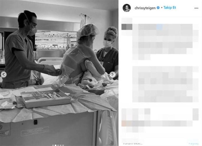 Chrissy Teigen'den kötü haber! 'Daha önce böyle bir acı hissetmemiştik'